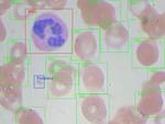 Blood cell detection from image using Mask-RCNN